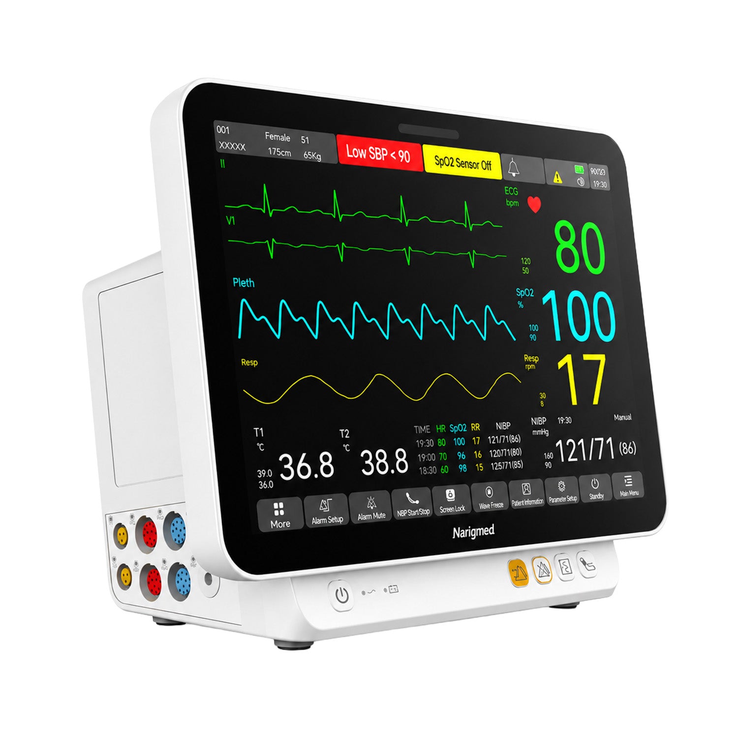V-Care Elite · Monitor Multiparámetro Veterinario 12.1" ECG + CO2