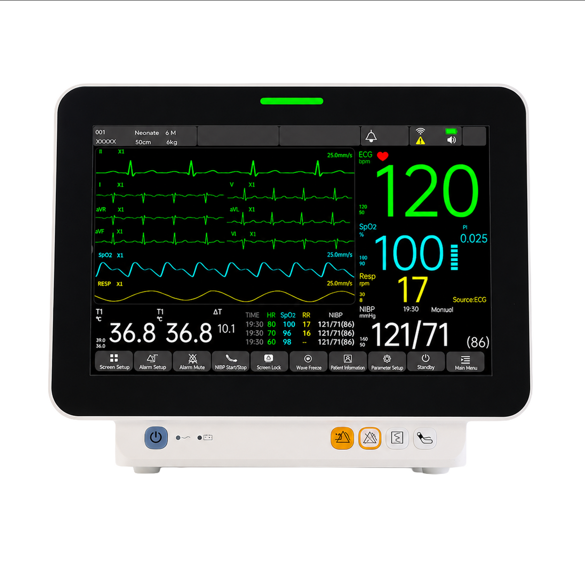 V-Care Elite - Monitor Multiparámetro Veterinario 12.1 pulgadas